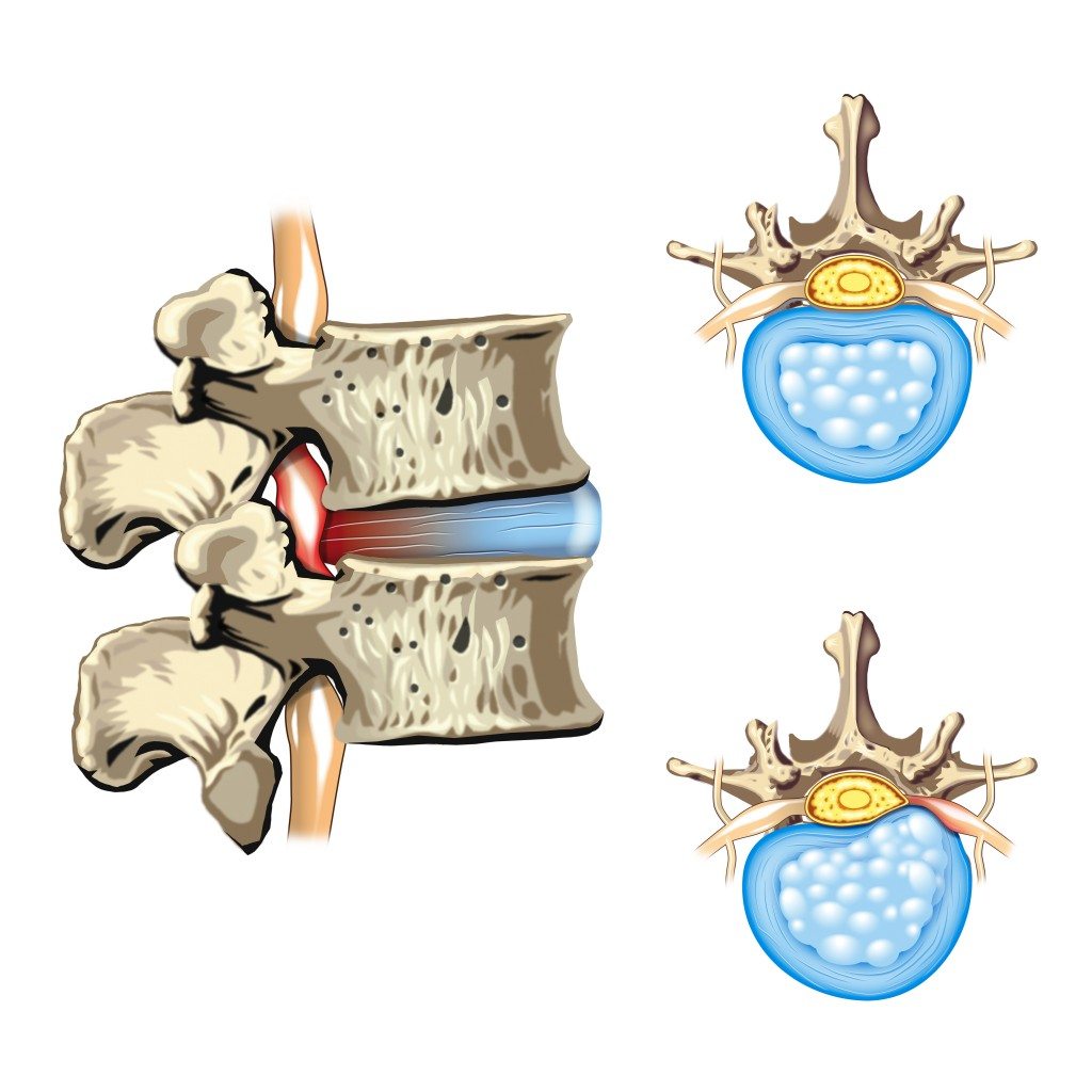 Pain Management