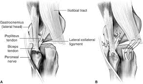 Posterolateral Knee Injuries