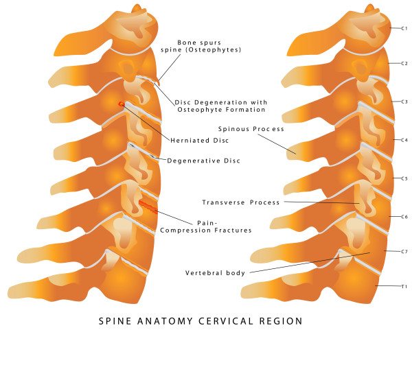 Cervical Spine 1 e1459199002158