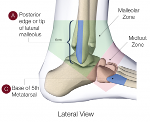 ankle lateral ankle lateral