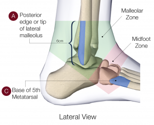 ankle lateral 300x245 1