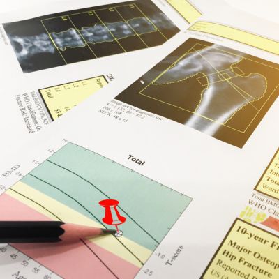 DEXA scan