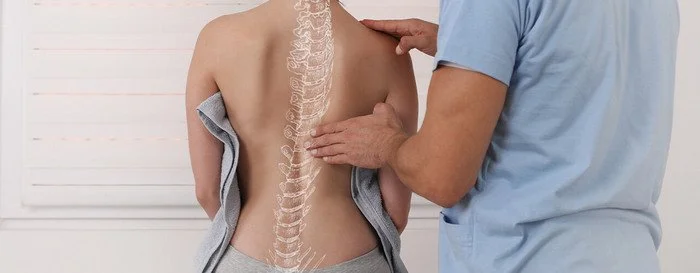 scoliosis back lady (1)